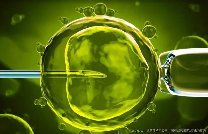 试管移植前必查：宫腔粘连对胚胎着床的影响