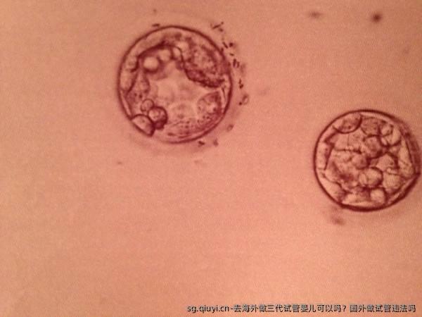 去海外做三代试管婴儿可以吗？国外做试管违法吗