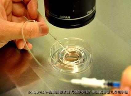 去美国做试管大概多少钱？美国试管婴儿费用明细
