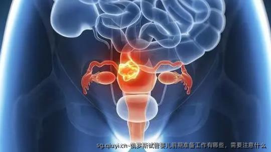 俄罗斯试管婴儿前期准备工作有哪些，需要注意什么