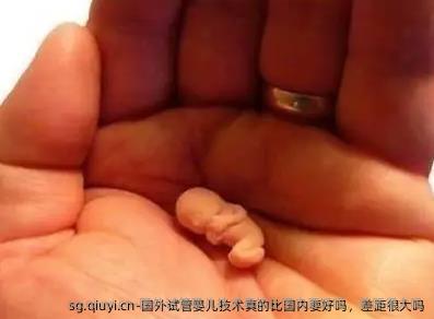 国外试管婴儿技术真的比国内要好吗，差距很大吗
