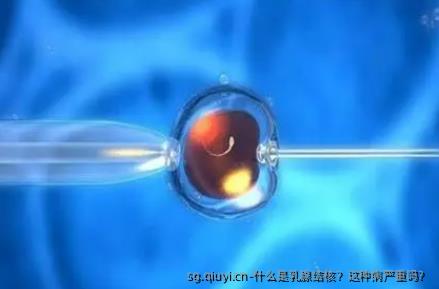 什么是乳腺结核？这种病严重吗？