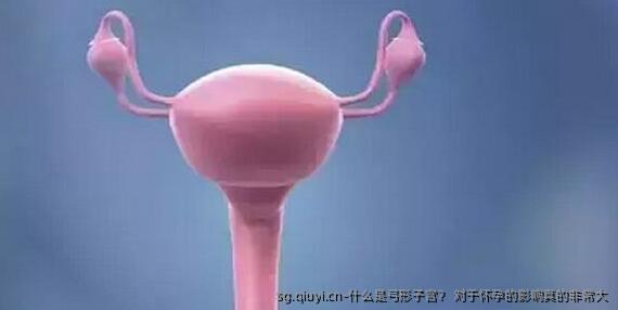 什么是弓形子宫？ 对于怀孕的影响真的非常大