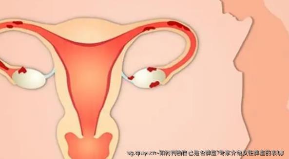 如何判断自己是否脾虚?专家介绍女性脾虚的表现!