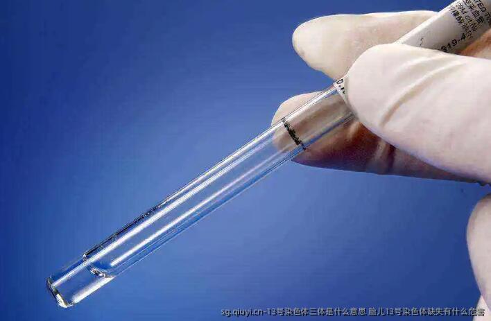 13号染色体三体是什么意思 胎儿13号染色体缺失有什么危害