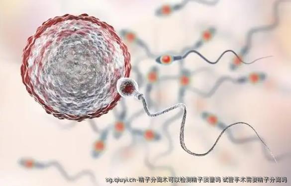 精子分离术可以检测精子质量吗 试管手术需要精子分离吗