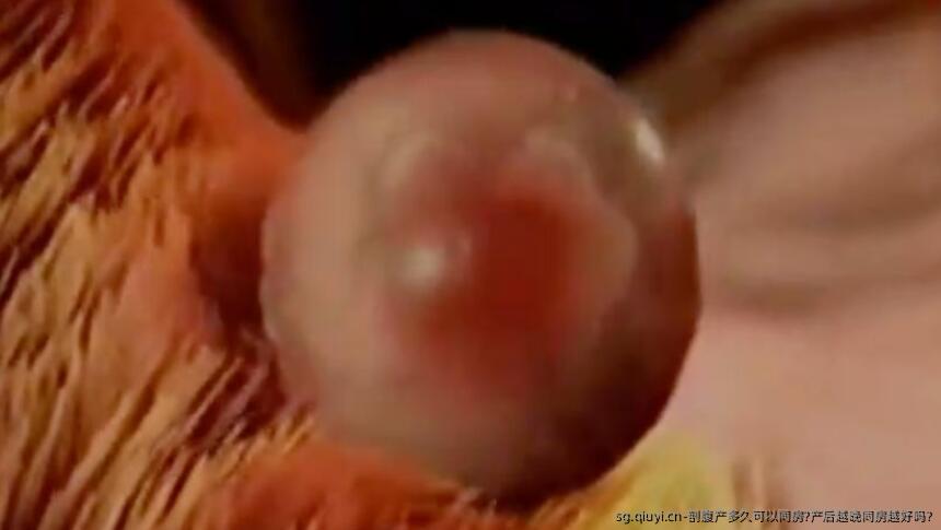 剖腹产多久可以同房?产后越晚同房越好吗?