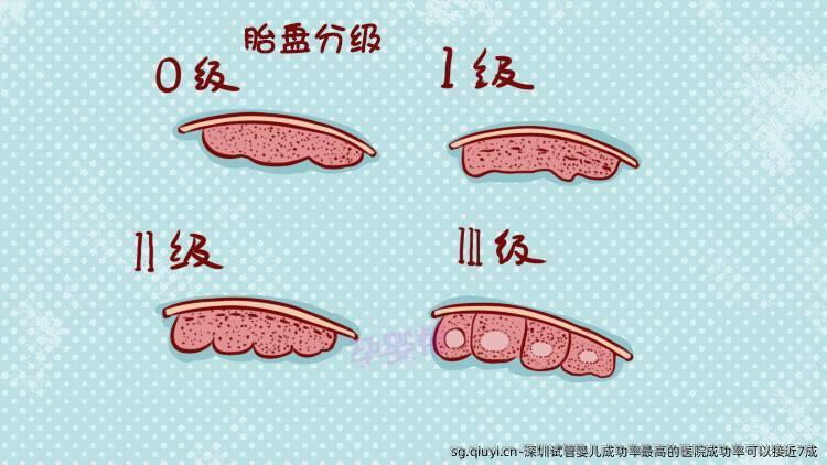 深圳试管婴儿成功率最高的医院成功率可以接近7成