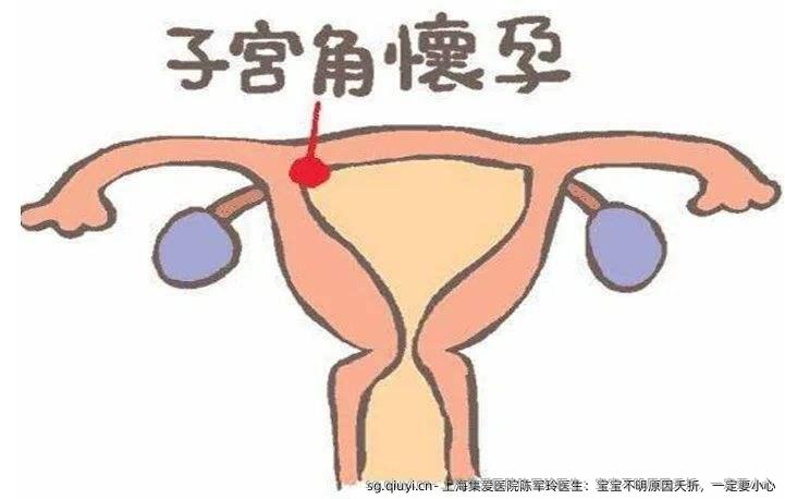  上海集爱医院陈军玲医生：宝宝不明原因夭折，一定要小心