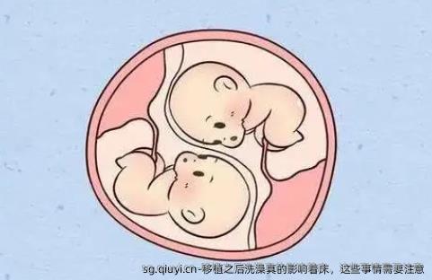 移植之后洗澡真的影响着床，这些事情需要注意