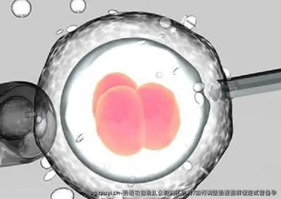 肠道功能紊乱会影响怀孕吗?如何调整肠道菌群促进试管备孕