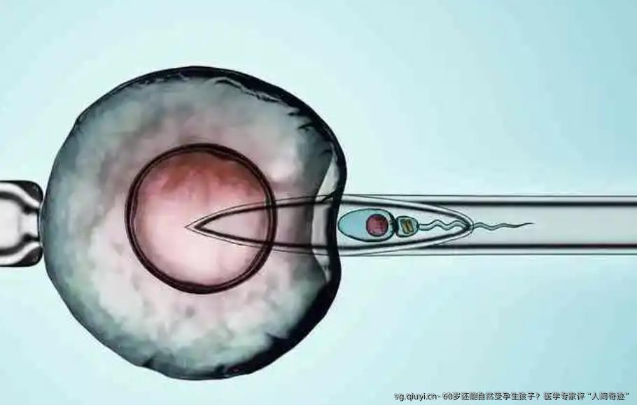  60岁还能自然受孕生孩子？医学专家评“人间奇迹”