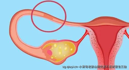 小栗旬老婆山田优是不是试管生三胎