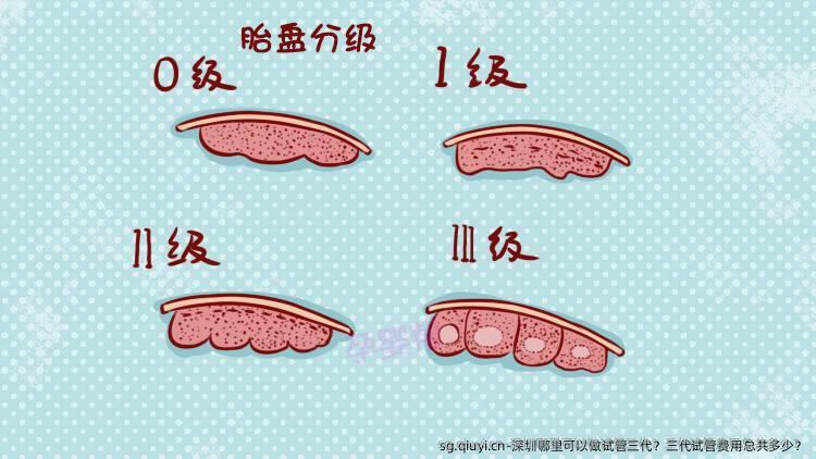 深圳哪里可以做试管三代？三代试管费用总共多少？