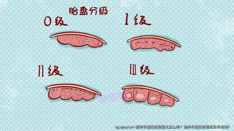 漳州市医院试管婴儿怎么样？漳州市医院试管成功率高吗？