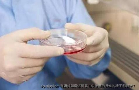有姐妹知道试管婴儿中使用的是谁的精子和卵子？