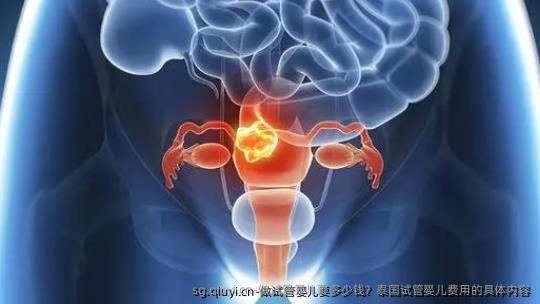 做试管婴儿要多少钱？泰国试管婴儿费用的具体内容