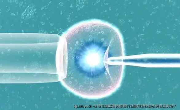 在浙江做试管选择嘉兴妇保院好还是杭州邵逸夫好？