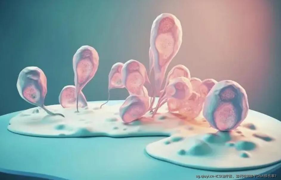 ICSI治疗前，如何检测精子DNA损伤率？