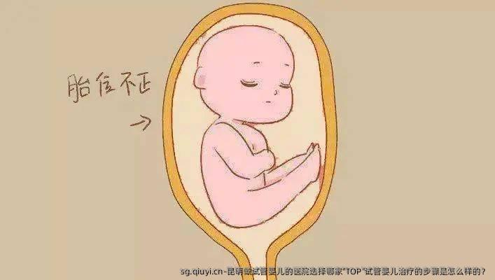 昆明做试管婴儿的医院选择哪家