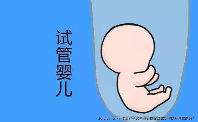 手术治疗子宫内膜异位症对成功率提升有帮助吗？