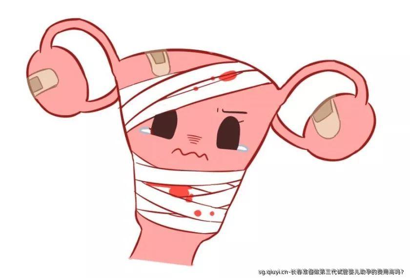 长春准备做第三代试管婴儿助孕的费用高吗？