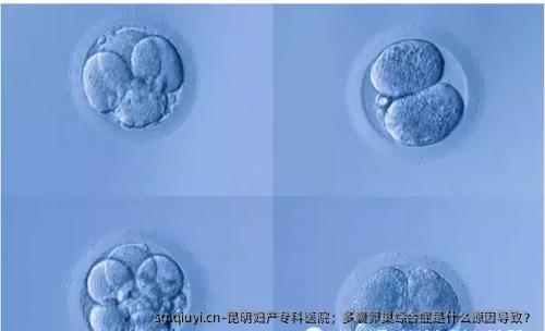 昆明妇产专科医院；多囊卵巢综合症是什么原因导致？