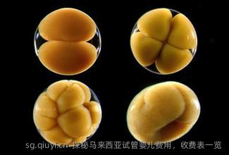探秘马来西亚试管婴儿费用，收费表一览