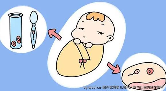 国外试管婴儿技术：真的比国内好在哪里