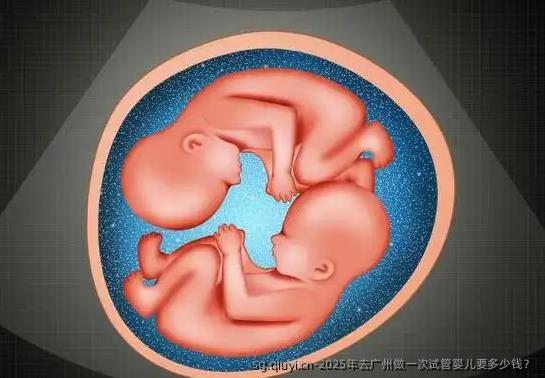 2025年去广州做一次试管婴儿要多少钱？