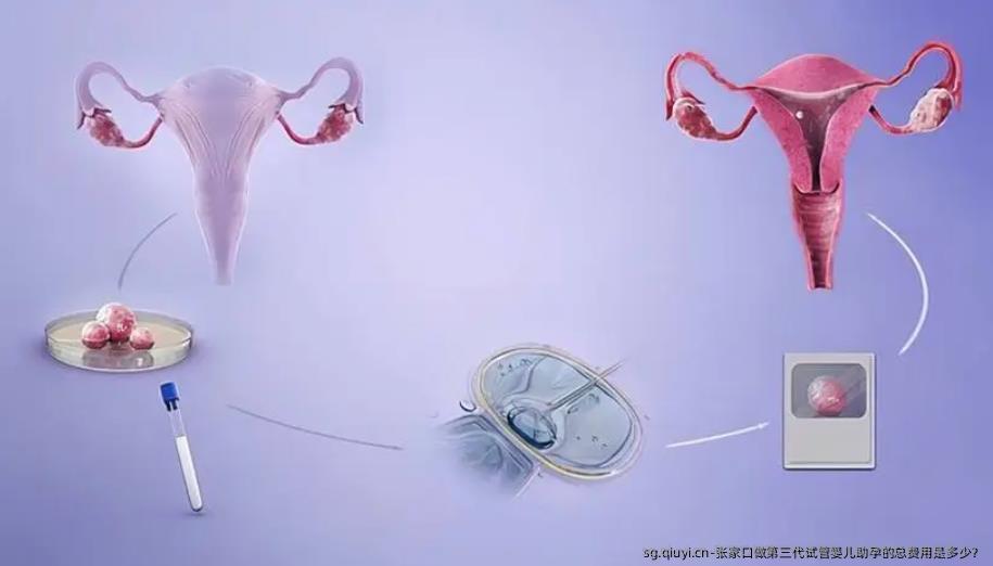 张家口做第三代试管婴儿助孕的总费用是多少？