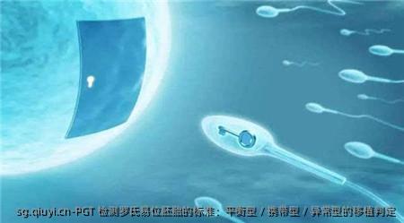 PGT 检测罗氏易位胚胎的标准：平衡型 / 携带型 / 异常型的移植判定