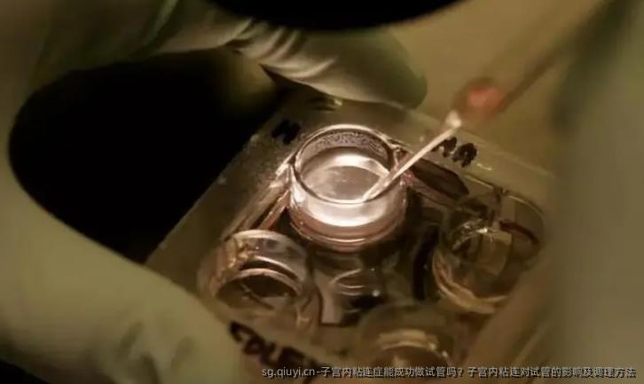 子宫内粘连症能成功做试管吗？子宫内粘连对试管的影响及调理方法
