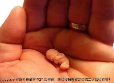罗氏易位试管 PGT 后管理：胚胎移植失败是否需二次活检检测？