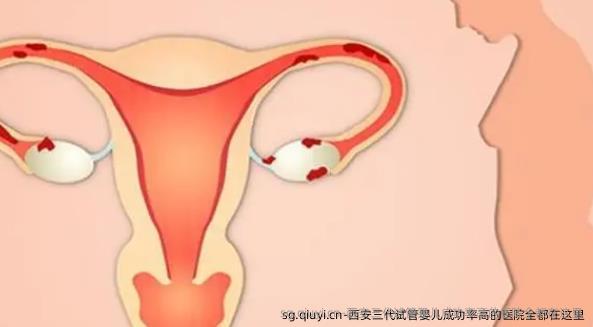 西安三代试管婴儿成功率高的医院全都在这里