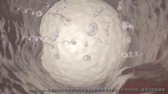 无锡找私立机构做三代试管婴儿的费用多少？公开各项目明细，看完记得收藏哦