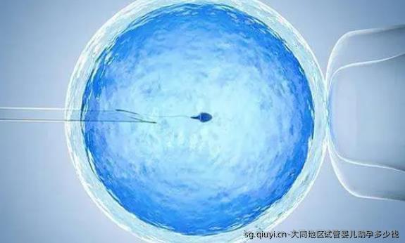 大同地区试管婴儿助孕多少钱
