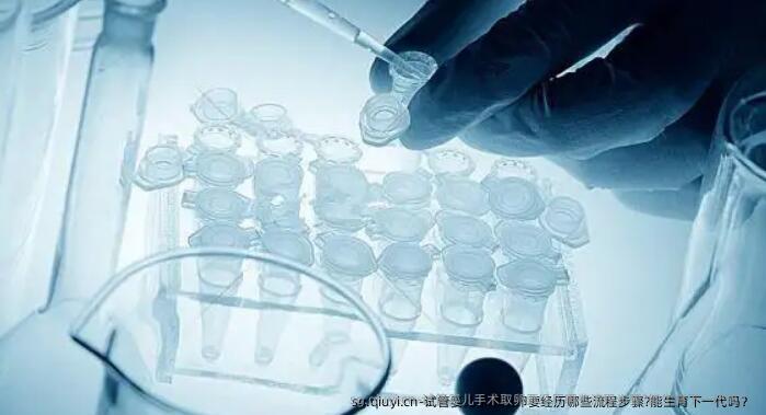 试管婴儿手术卵泡取出要经历哪些流程步骤?能生育下一代吗？ 