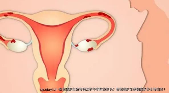 泰国辅助生殖移植后梦中惊醒正常吗？泰国辅助生殖翻译是否全程陪同？