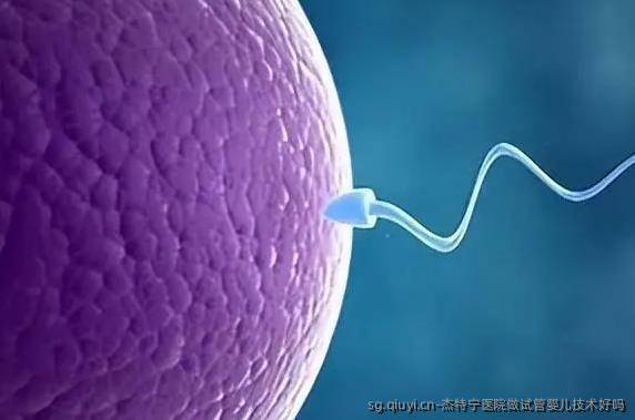 杰特宁医院做试管婴儿技术好吗