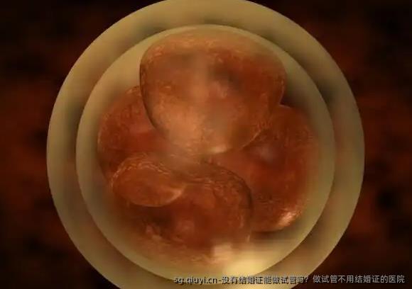 没有结婚证能做试管吗？做试管不用结婚证的医院