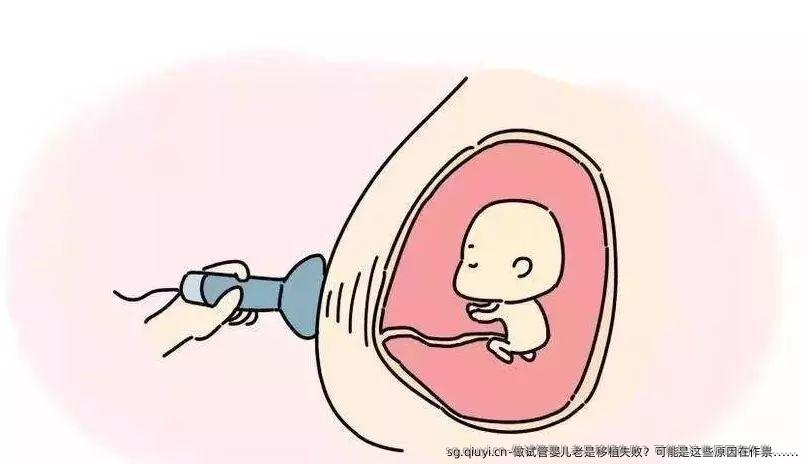 做试管婴儿老是移植失败？可能是这些原因在作祟……