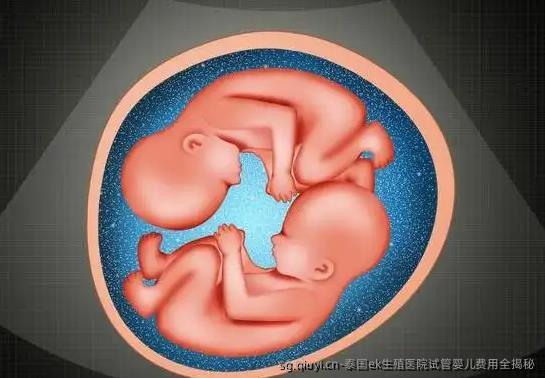 泰国ek生殖医院试管婴儿费用全揭秘