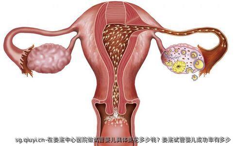 在娄底中心医院做试管婴儿具体要花多少钱？娄底试管婴儿成功率有多少