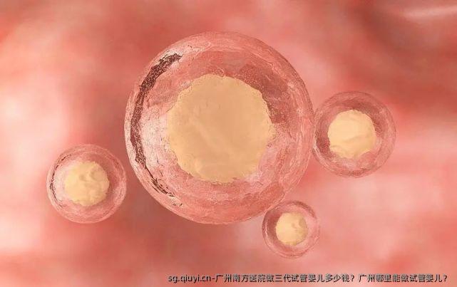 广州南方医院做三代试管婴儿多少钱？广州哪里能做试管婴儿？