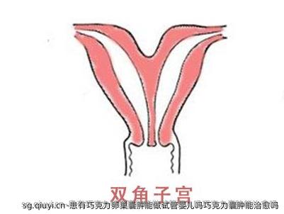 患有巧克力卵巢囊肿能做试管婴儿吗巧克力囊肿能治愈吗