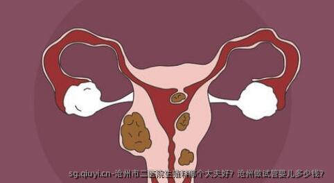 沧州市二医院生殖科哪个大夫好？沧州做试管婴儿多少钱？