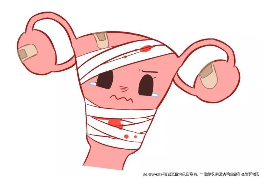 阴到炎症可以自愈吗，一般多久阴道炎病因是什么怎样预防