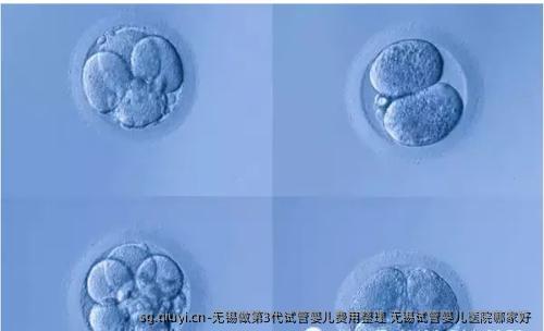 无锡做第3代试管婴儿费用整理 无锡试管婴儿医院哪家好 