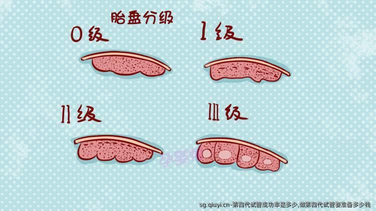 第四代试管成功率是多少,做第四代试管要准备多少钱 